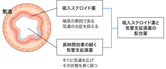 吸入ステロイド薬と気管支拡張薬の配合薬の説明