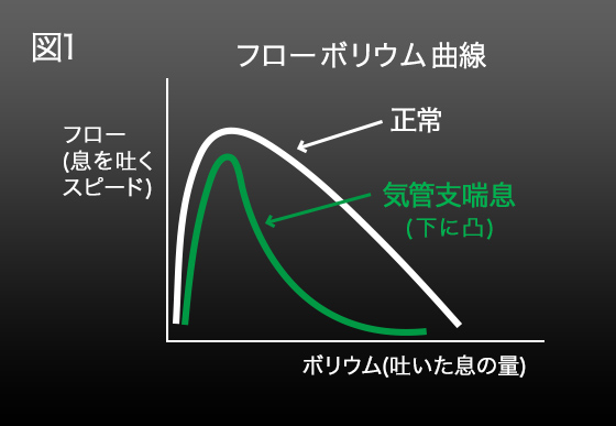 図1 フローボリューム曲線、