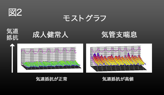 図2 モストグラフ